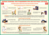Таблица Порядок действий при опасном кровотечении 1000*1400 винил - «globural.ru» - Мытищи