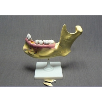 Модель "Челюсть разборная" - «globural.ru» - Мытищи