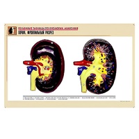 Рельефная таблица "Почка. Фронтальный разрез" (формат А1, матовое ламинир.) - «globural.ru» - Мытищи
